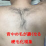 横浜のメンズ脱毛/完全都度払いで安い男性専用脱毛サロン